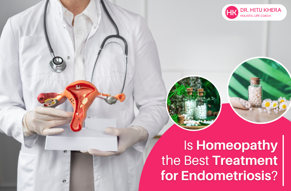 Endometriosis