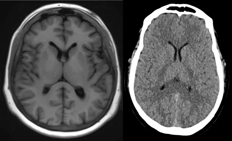 Understanding MRI Anatomy: A Complete Guide for Beginners