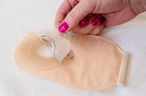How Can Ostomy Supplies Help You Prevent Leaks and Skin Issues