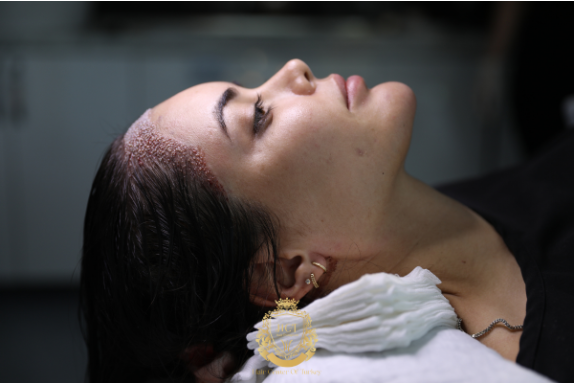 Hair Center of Turkey Redefines the Future of Hair Transplant in Turkey with Advanced Artificial Intelligence