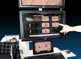 Transform Your Skincare and Health with Advanced Molemax Systems Solutions