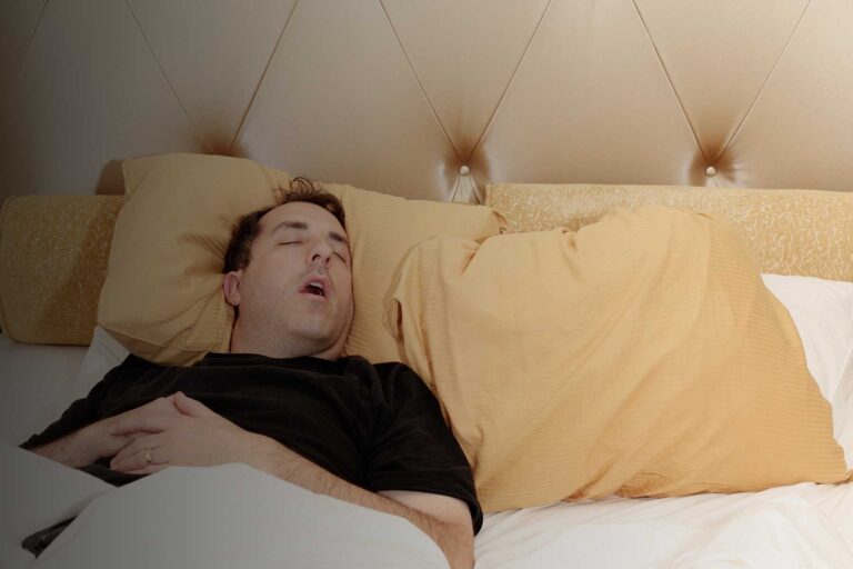 Obstructive Sleep Apnea
